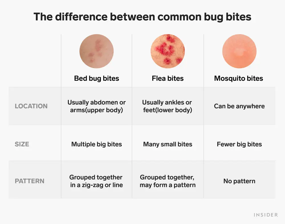 difference between common bug bites