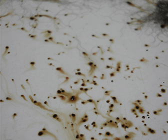 fleas on mattress